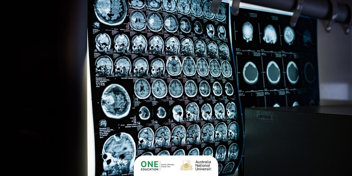 ANU - Neuroscience