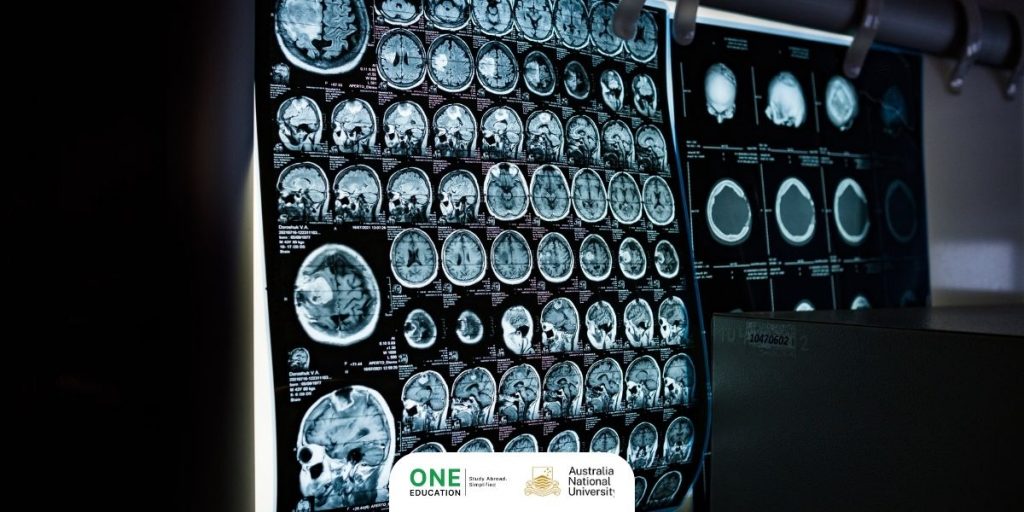 ANU - Neuroscience